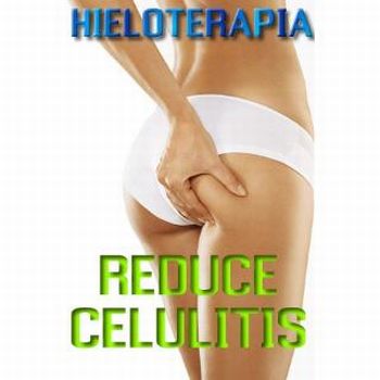 hieloterapia hieloterapia La hieloterapia para adelgazar